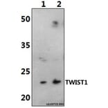 Anti-TWIST1 (M1) Antibody from Bioworld Technology (AP0020) - Antibodies.com