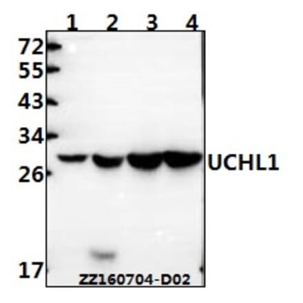 Anti-UCHL1 Antibody from Bioworld Technology (AP0021) - Antibodies.com