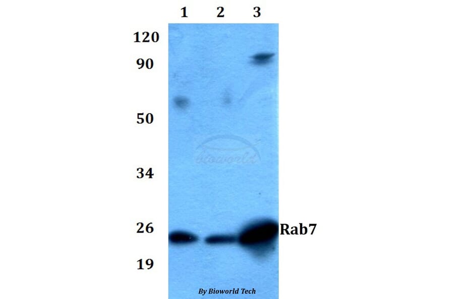 Anti-Rab7 Antibody from Bioworld Technology (AP0030) - Antibodies.com