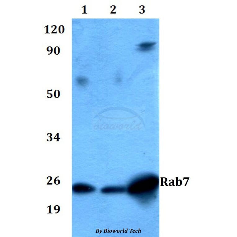 Anti-Rab7 Antibody from Bioworld Technology (AP0030) - Antibodies.com