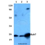 Anti-Rab7 Antibody from Bioworld Technology (AP0030) - Antibodies.com
