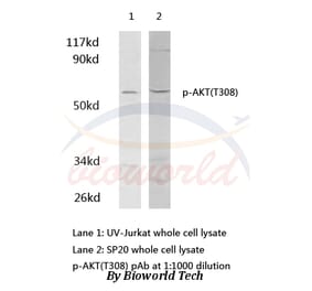 Anti-AKT (phospho-T308) Antibody from Bioworld Technology (AP0056) - Antibodies.com