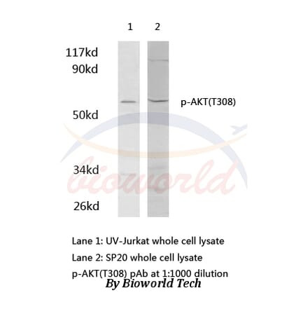 Anti-AKT (phospho-T308) Antibody from Bioworld Technology (AP0056) - Antibodies.com