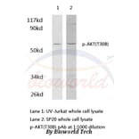 Anti-AKT (phospho-T308) Antibody from Bioworld Technology (AP0056) - Antibodies.com