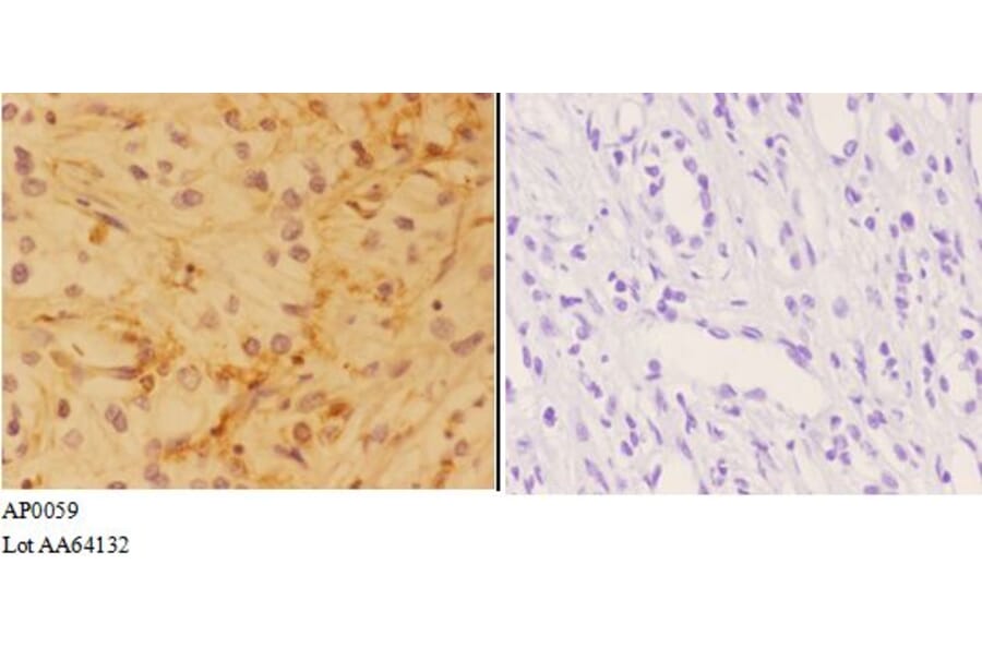 Anti-AKT Antibody from Bioworld Technology (AP0059) - Antibodies.com