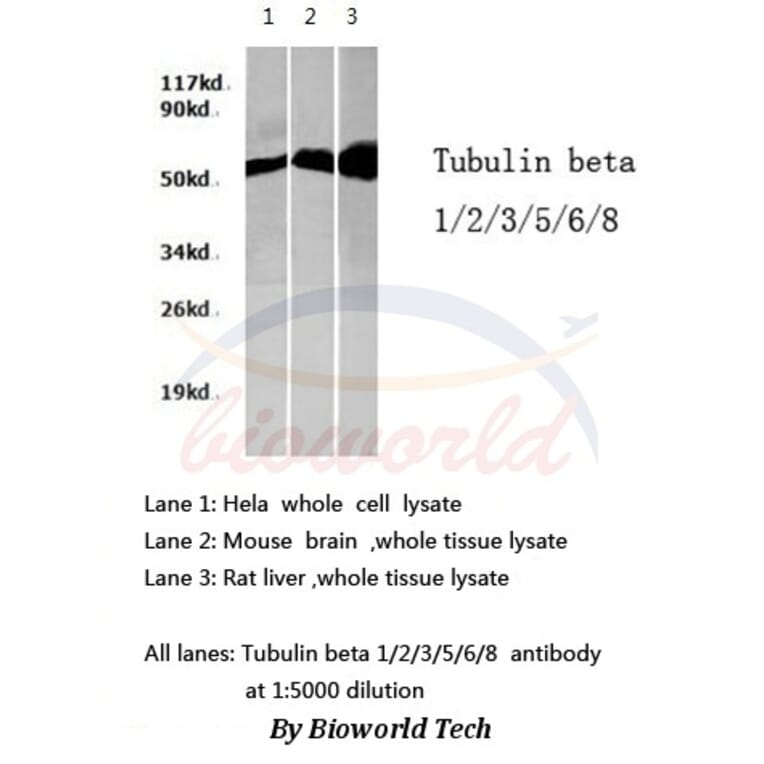 Anti-Tubulin β Antibody from Bioworld Technology (AP0064) - Antibodies.com