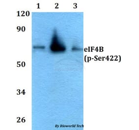 Anti-eIF4B (phospho-Ser422) Antibody from Bioworld Technology (AP0084) - Antibodies.com