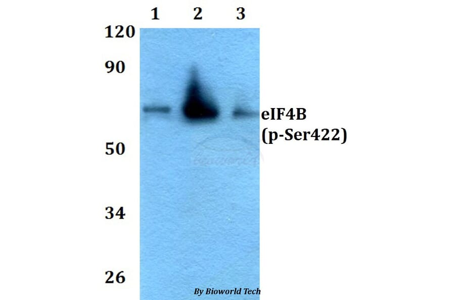 Anti-eIF4B (phospho-Ser422) Antibody from Bioworld Technology (AP0084) - Antibodies.com