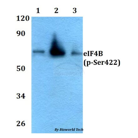 Anti-eIF4B (phospho-Ser422) Antibody from Bioworld Technology (AP0084) - Antibodies.com