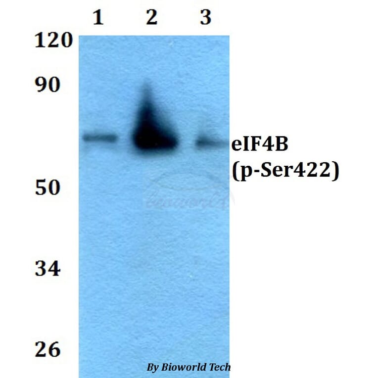 Anti-eIF4B (phospho-Ser422) Antibody from Bioworld Technology (AP0084) - Antibodies.com
