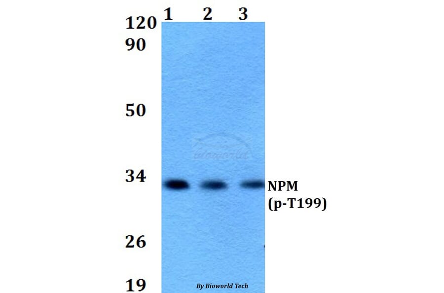 Anti-NPM (phospho-T199) Antibody from Bioworld Technology (AP0100) - Antibodies.com