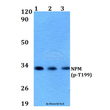 Anti-NPM (phospho-T199) Antibody from Bioworld Technology (AP0100) - Antibodies.com