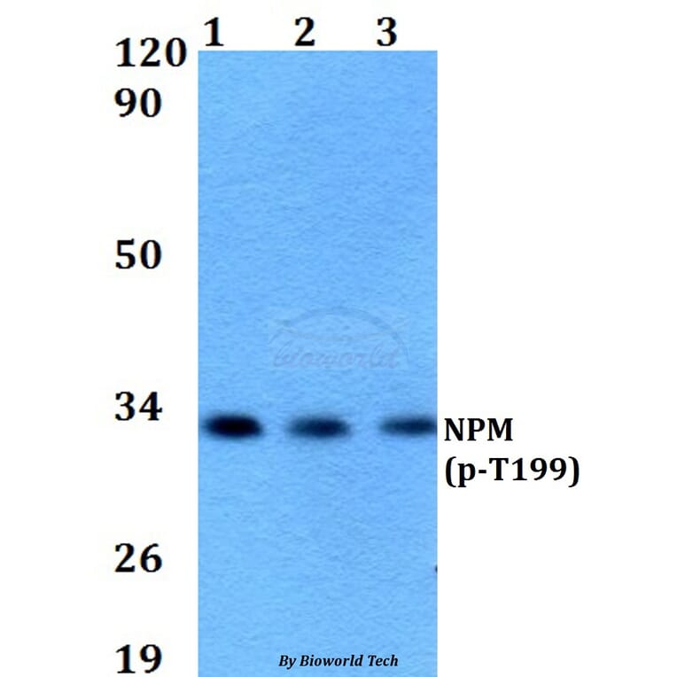 Anti-NPM (phospho-T199) Antibody from Bioworld Technology (AP0100) - Antibodies.com