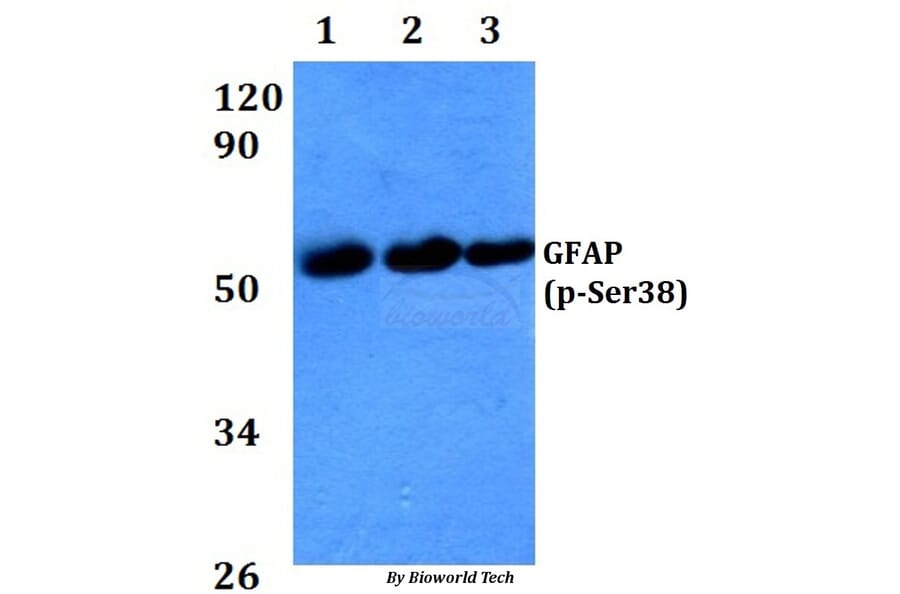 Anti-GFAP (phospho-Ser38) Antibody from Bioworld Technology (AP0149) - Antibodies.com