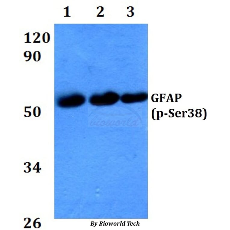 Anti-GFAP (phospho-Ser38) Antibody from Bioworld Technology (AP0149) - Antibodies.com