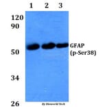 Anti-GFAP (phospho-Ser38) Antibody from Bioworld Technology (AP0149) - Antibodies.com