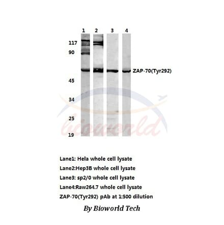 Anti-ZAP70 (Tyr292) Antibody from Bioworld Technology (AP0158) - Antibodies.com