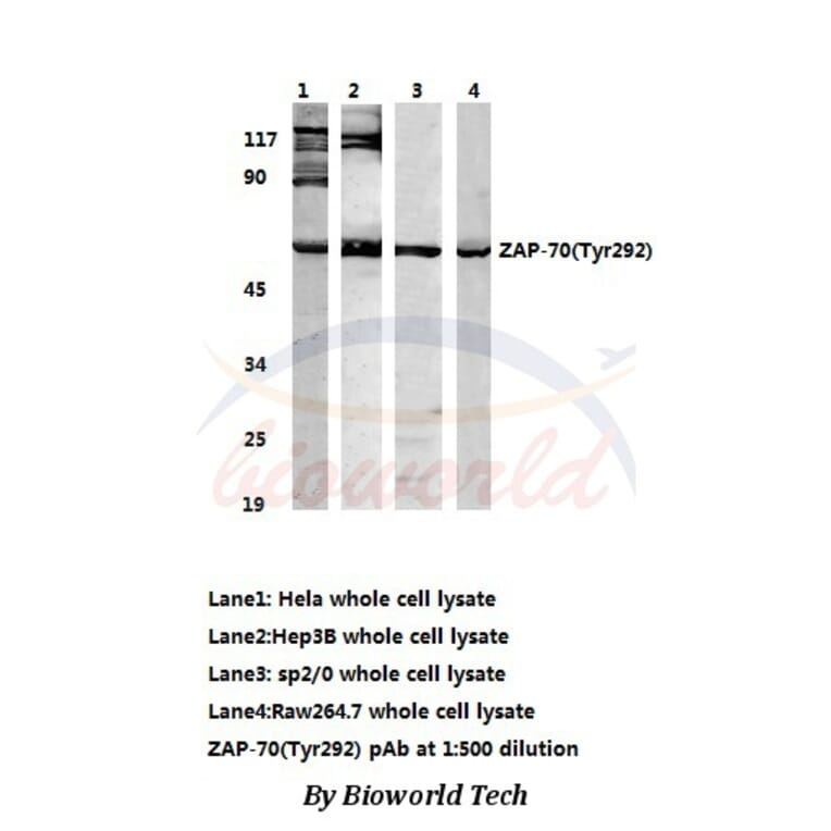 Anti-ZAP70 (Tyr292) Antibody from Bioworld Technology (AP0158) - Antibodies.com