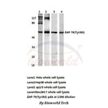 Anti-ZAP70 (Tyr292) Antibody from Bioworld Technology (AP0158) - Antibodies.com