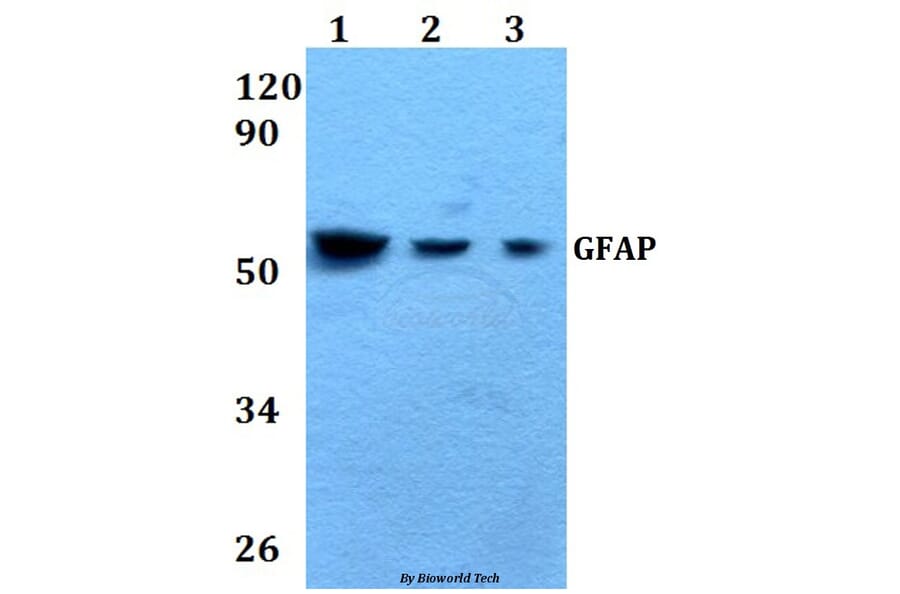Anti-GFAP (Ser38) Antibody from Bioworld Technology (AP0227) - Antibodies.com