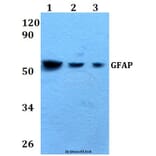 Anti-GFAP (Ser38) Antibody from Bioworld Technology (AP0227) - Antibodies.com