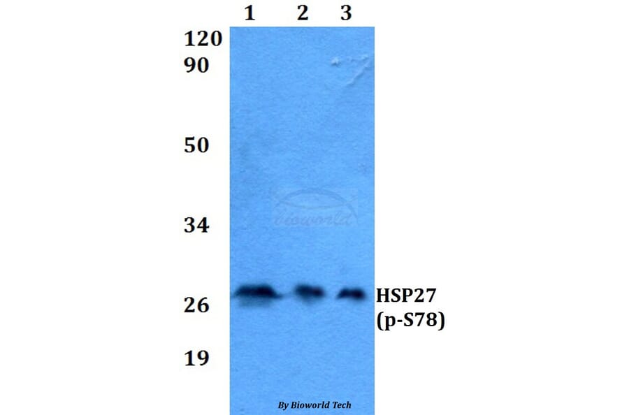 Anti-HSP27 (phospho-S78) Antibody from Bioworld Technology (AP0243) - Antibodies.com