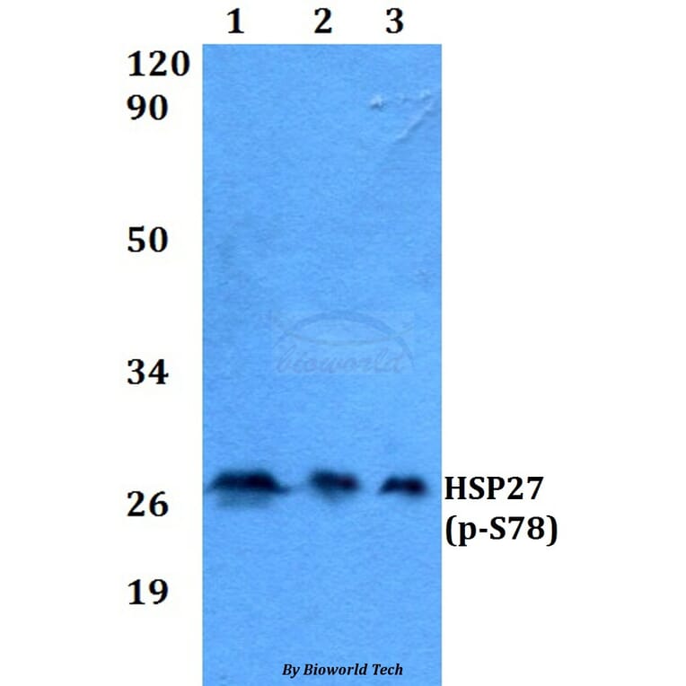 Anti-HSP27 (phospho-S78) Antibody from Bioworld Technology (AP0243) - Antibodies.com