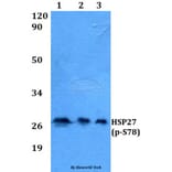 Anti-HSP27 (phospho-S78) Antibody from Bioworld Technology (AP0243) - Antibodies.com