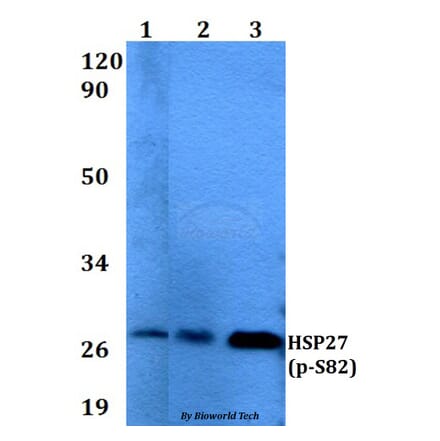 Anti-HSP27 (phospho-S82) Antibody from Bioworld Technology (AP0244) - Antibodies.com