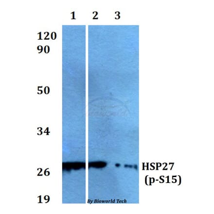 Anti-HSP27 (phospho-S15) Antibody from Bioworld Technology (AP0245) - Antibodies.com
