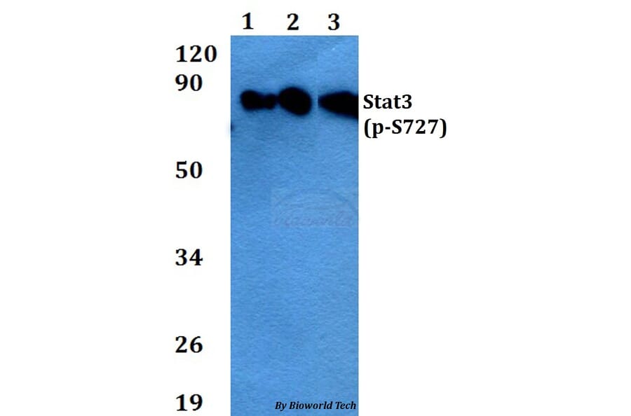 Anti-Stat3 (phospho-S727) Antibody from Bioworld Technology (AP0248) - Antibodies.com