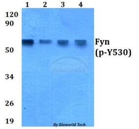 Anti-Fyn (phospho-Y530) Antibody from Bioworld Technology (AP0263) - Antibodies.com