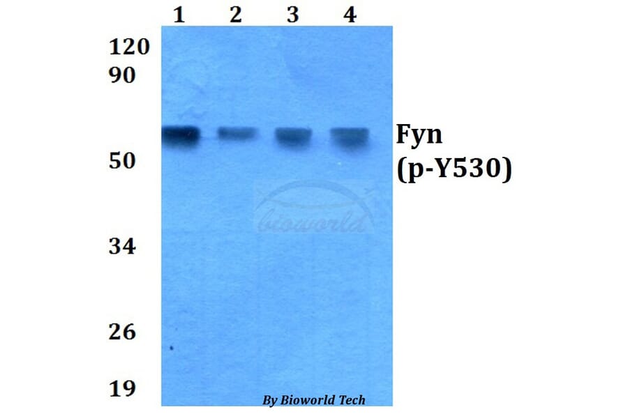 Anti-Fyn (phospho-Y530) Antibody from Bioworld Technology (AP0263) - Antibodies.com