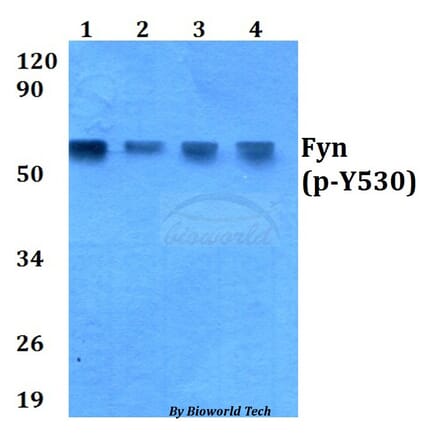 Anti-Fyn (phospho-Y530) Antibody from Bioworld Technology (AP0263) - Antibodies.com