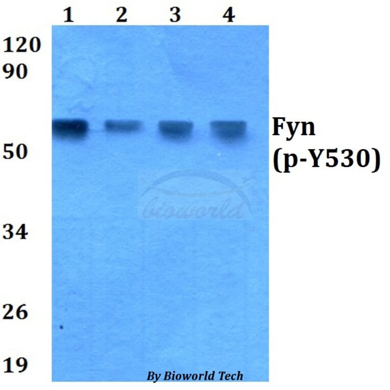 Anti-Fyn (phospho-Y530) Antibody from Bioworld Technology (AP0263) - Antibodies.com