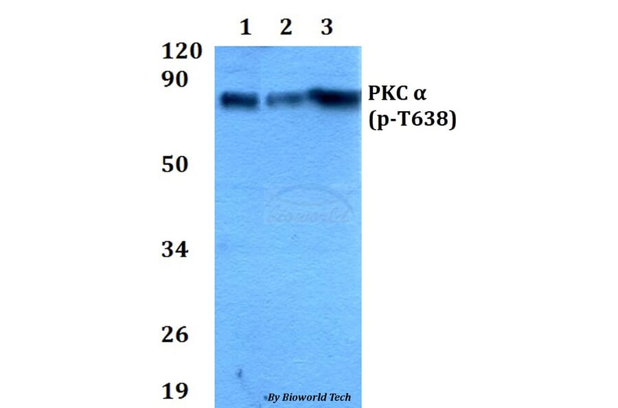 Anti-PKC α (phospho-T638) Antibody from Bioworld Technology (AP0290) - Antibodies.com