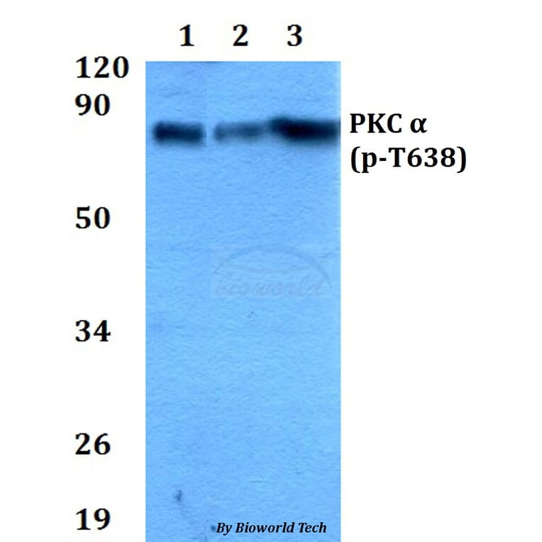 Anti-PKC α (phospho-T638) Antibody from Bioworld Technology (AP0290) - Antibodies.com