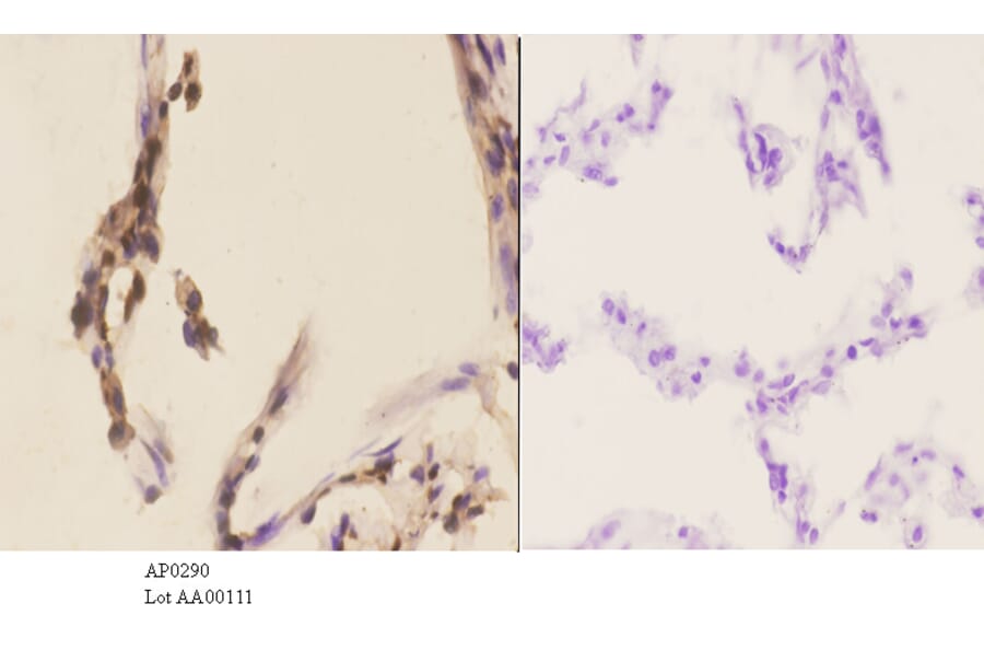 Anti-PKC α (phospho-T638) Antibody from Bioworld Technology (AP0290) - Antibodies.com
