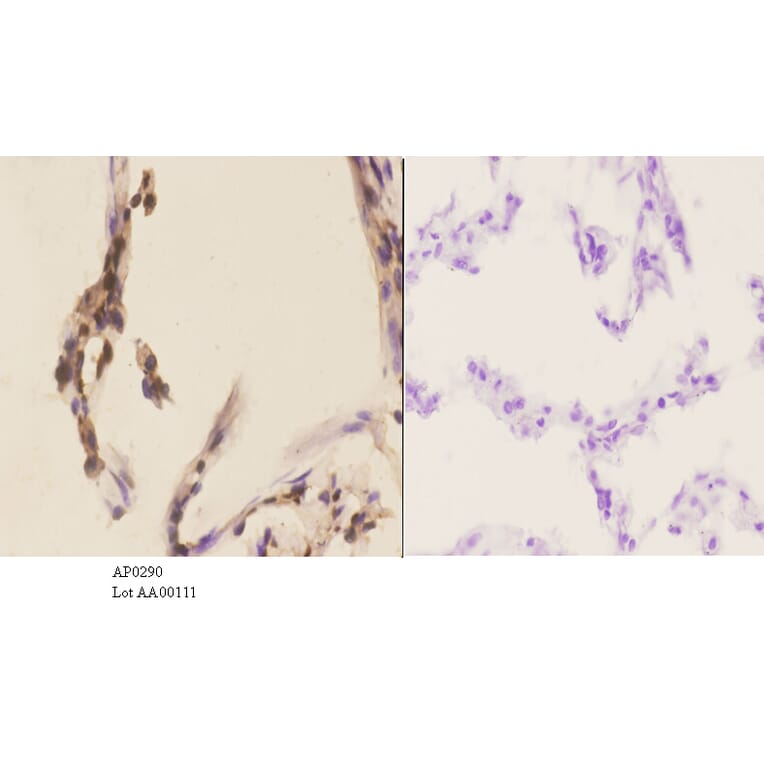 Anti-PKC α (phospho-T638) Antibody from Bioworld Technology (AP0290) - Antibodies.com