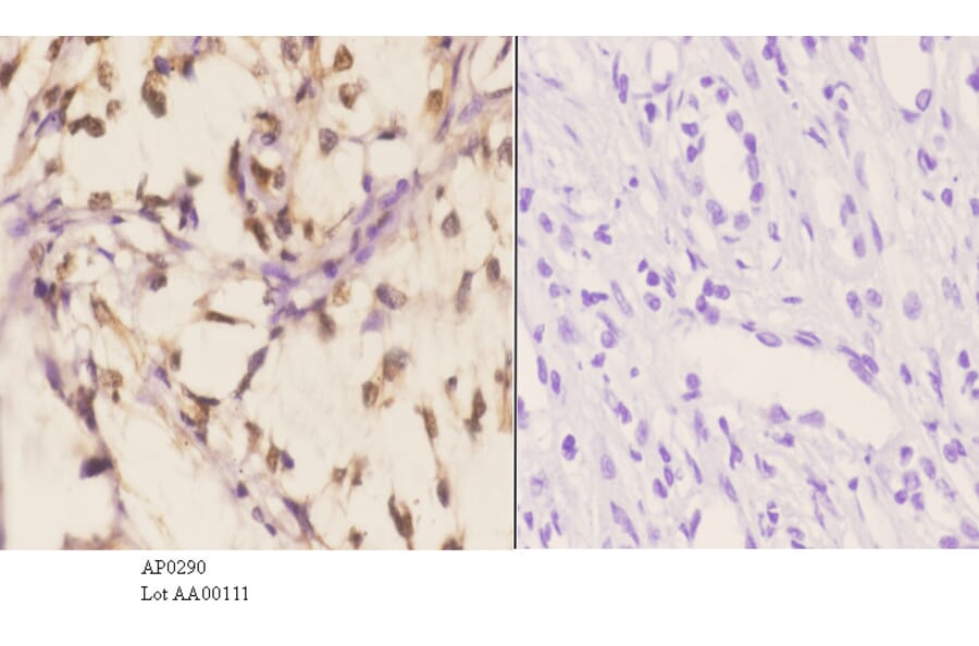 Anti-PKC α (phospho-T638) Antibody from Bioworld Technology (AP0290) - Antibodies.com