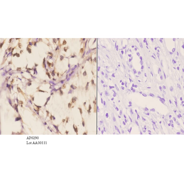 Anti-PKC α (phospho-T638) Antibody from Bioworld Technology (AP0290) - Antibodies.com