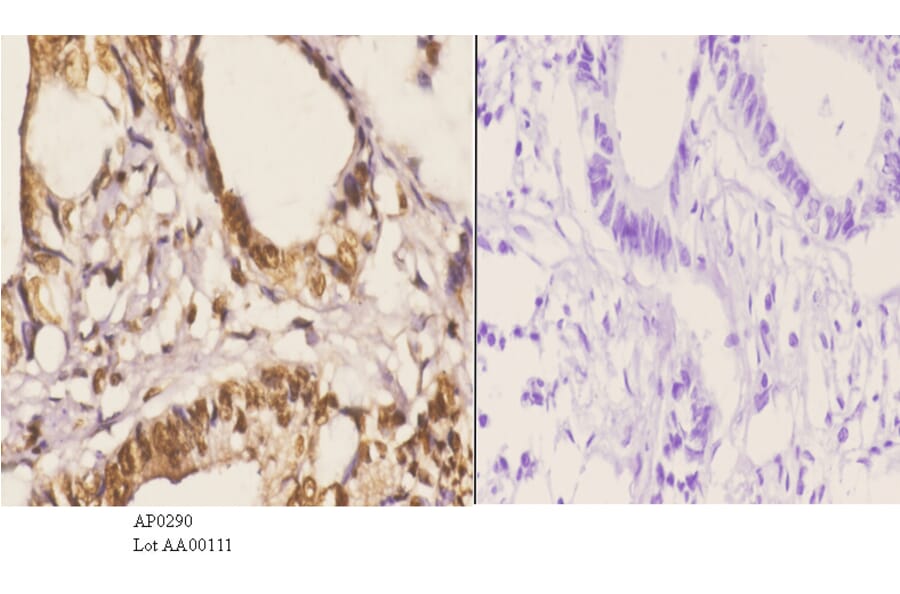 Anti-PKC α (phospho-T638) Antibody from Bioworld Technology (AP0290) - Antibodies.com