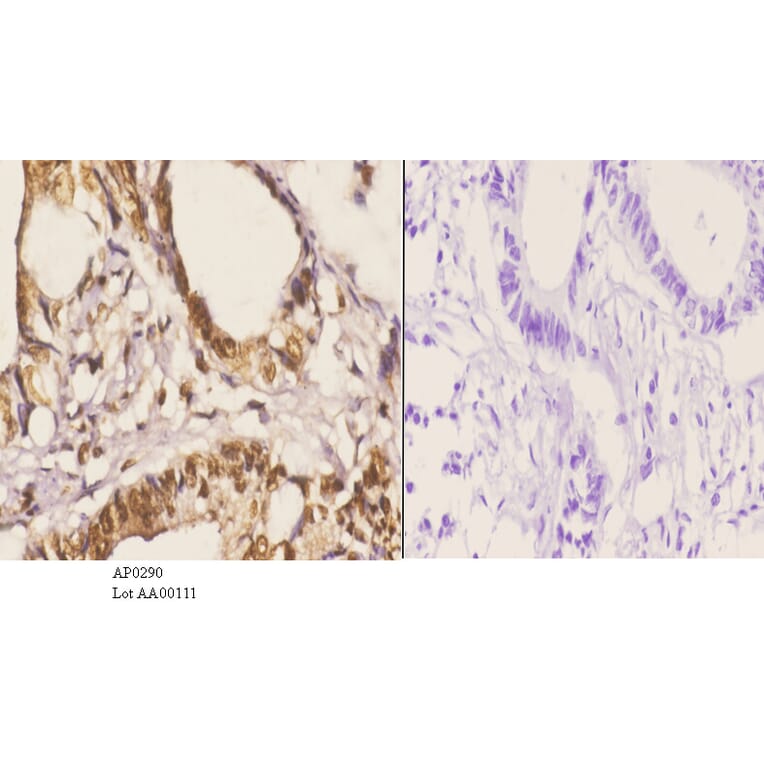 Anti-PKC α (phospho-T638) Antibody from Bioworld Technology (AP0290) - Antibodies.com
