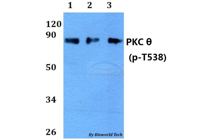Anti-PKC θ (phospho-T538) Antibody from Bioworld Technology (AP0292) - Antibodies.com