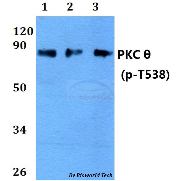 Anti-PKC θ (phospho-T538) Antibody from Bioworld Technology (AP0292) - Antibodies.com