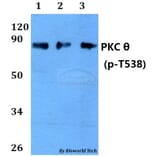 Anti-PKC θ (phospho-T538) Antibody from Bioworld Technology (AP0292) - Antibodies.com