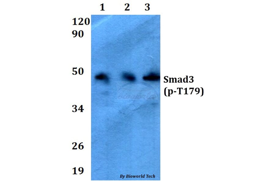 Anti-Smad3 (phospho-T179) Antibody from Bioworld Technology (AP0327) - Antibodies.com