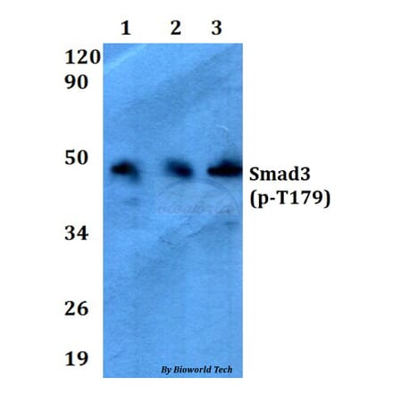 Anti-Smad3 (phospho-T179) Antibody from Bioworld Technology (AP0327) - Antibodies.com