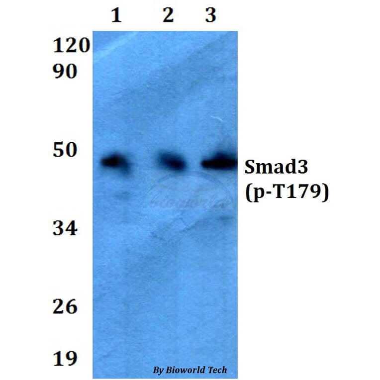 Anti-Smad3 (phospho-T179) Antibody from Bioworld Technology (AP0327) - Antibodies.com