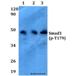 Anti-Smad3 (phospho-T179) Antibody from Bioworld Technology (AP0327) - Antibodies.com